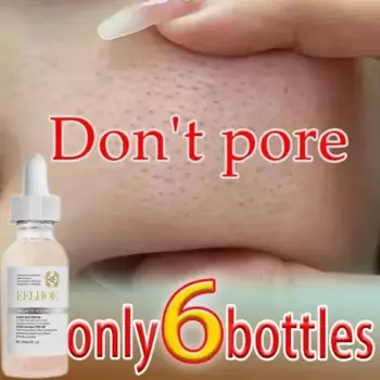 10% Lactic Acid Pore Shrinking Serum Reduce Acne Scar Large Pore Product for Men Women Tighten Facial Pore Minimizing Ordinary