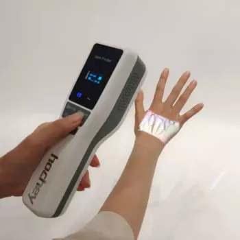 MT Medical, высокое разрешение, многоцветный дисплей, ручной фотовспышка