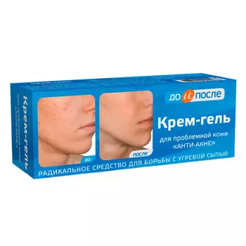 До и После Крем-гель от акне д/проблемной кожи 50 мл