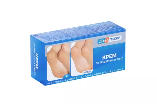 Крем До и После от трещин в ступнях, 150 мл