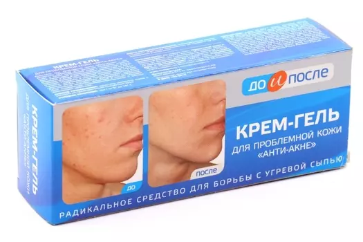 Крем-гель До и После Анти-Акне, 50 мл