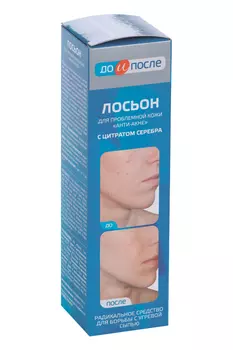 Лосьон Анти-Акне д/проблемной кожи до и после, 200 мл