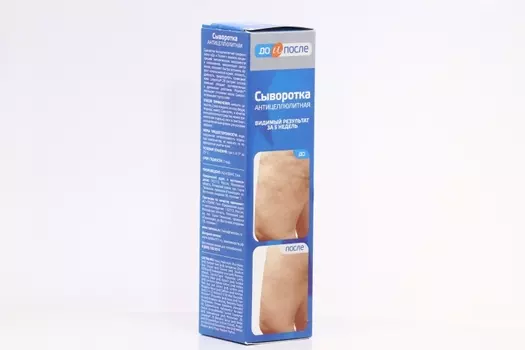 Сыворотка TWINS Tec от целлюлита антицеллюлитная до и после, 130 мл