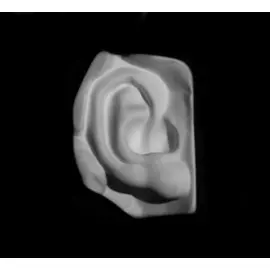 Гипс Ухо Давида правое