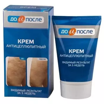 Антицеллюлитный крем "До и после"