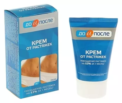 Крем от растяжек