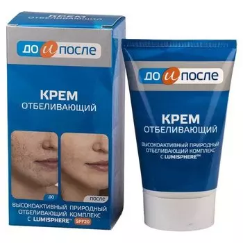 Отбеливающий крем "До и после"