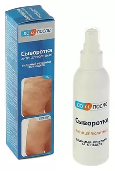 Сыворотка Антицеллюлитная