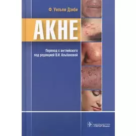 Акне
