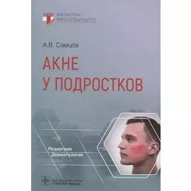 Акне у подростков