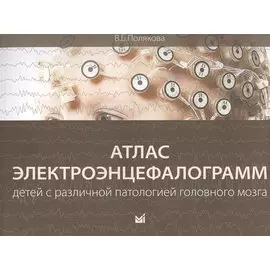 Атлас электроэнцефалограмм детей с различной патологией головного мозга