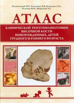Атлас клинической рентгеноанатомии височной кости новорожденных, детей грудного и раннего возраста