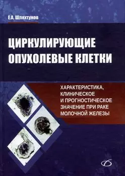 Циркулирующие опухолевые клетки: характеристика, клиническое и прогностическое значение при раке молочной железы