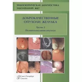 Доброкачественные опухоли желудка. Часть 2 Неэпителиальные опухоли
