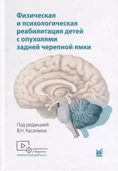 Физическая и психологическая реабилитация детей с опухолями задней черепной ямки