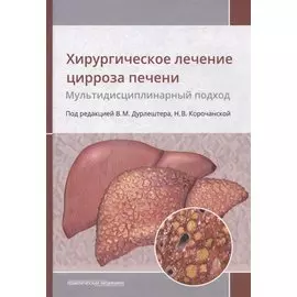 Хирургическое лечение цирроза печени. Мультидисциплинарный подход. Монография