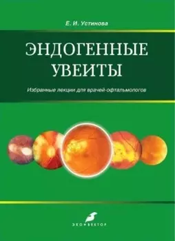 Эндогенные увеиты
