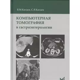 Компьютерная томография в гастроэнтерологии
