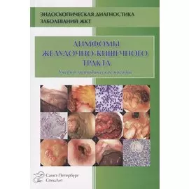 Лимфомы желудочно-кишечного тракта. Учебно-методическое пособие