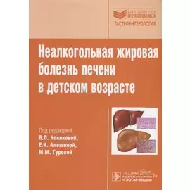 Неалкогольная жировая болезнь печени в детском возрасте