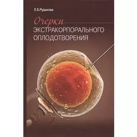 Очерки экстракорпорального оплодотворения.