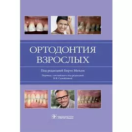 Ортодонтия взрослых