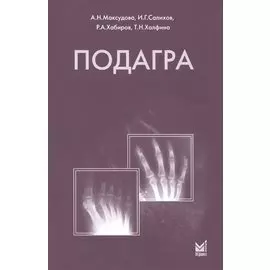 Подагра