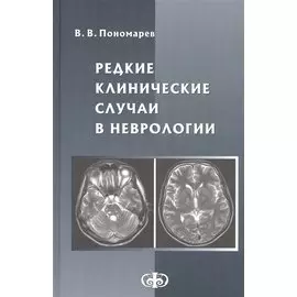 Редкие клинические случаи в неврологии. Руководство для врачей