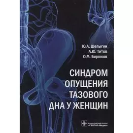 Синдром опущения тазового дна у женщин