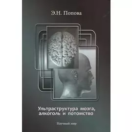 Ультраструктура мозга, алкоголь и потомство