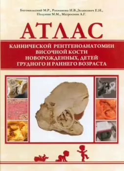 Атлас клинической рентгеноанатомии височной кости новорожденных, детей грудного и раннего возраста