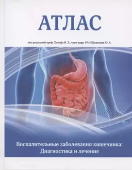 Атлас. Воспалительные заболевания кишечника. Диагностика и лечение