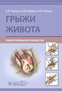 Грыжи живота: Иллюстрированное руководство