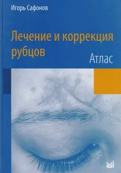Лечение и коррекция рубцов.Атлас