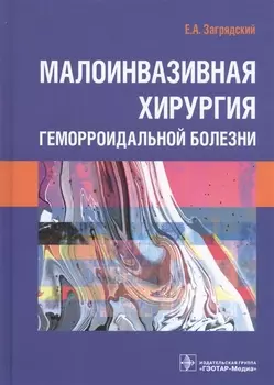 Малоинвазивная хирургия геморроидальной болезни