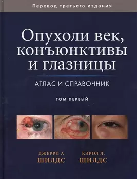 Опухоли век, конъюктивы и глазницы. Атлас и справочник. Том 1