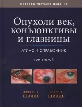 Опухоли век, конъюктивы и глазницы. Атлас и справочник т.2