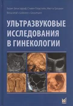 Ультразвуковые исследования в гинекологии