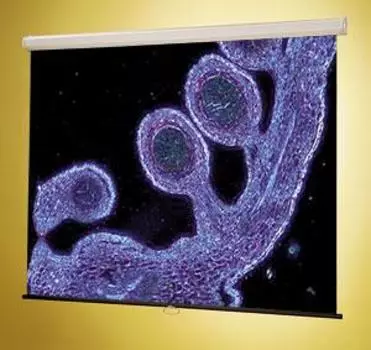 Проекционный экран_Luma 2 AV (1:1) 144/144 366*366 MW case white