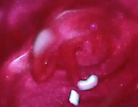 BEAUTIX Гель-3D без липкого слоя, 905 малиновый с шиммером 5 г