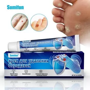 20 г крем для удаления мозолей на ногах Killer Foot Protection обезболивающий лечебный крем для лечения мозолей 20G