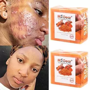 2 Turmeric Soap Skin Whitening Dark Spots lightening Acne Brightening Turmeric M оранжевый