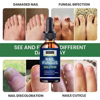 5 мл/15 мл/30 мл/50 мл/Crazylife Hand And Foot Nail Onycho Repair Nail Onychomycetant для утолщения ногтей, подавитель 5ml