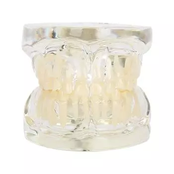 Dental Deciduous Teeth Model Removable Teeth Model Teaching Tool for Dentist