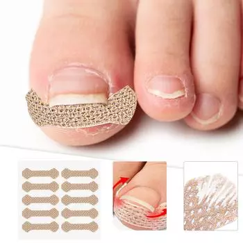 Наклейки для вросших ногтей One Size белый