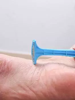 Premium Foot Care Tool for Removing Dry Skin and Calluses on Feet