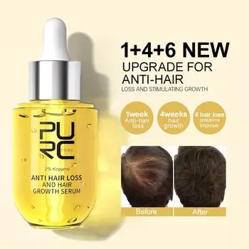 PURC Питательная жидкость для волос с имбирем Ginger King Питательная жидкость, восстанавливающее и питательное эфирное масло для волос Эфирное масло для плотных волос 50ml