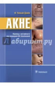 Акне