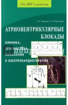 Атриовентрикулярные блокады. Клиника, диагностика, показания к электрокардиотерапии