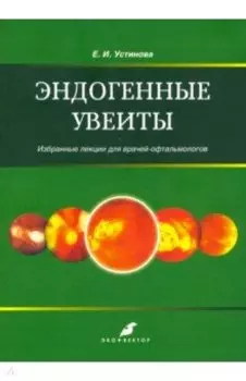 Эндогенные уевиты. Избранные лекции для врачей-офтальмологов